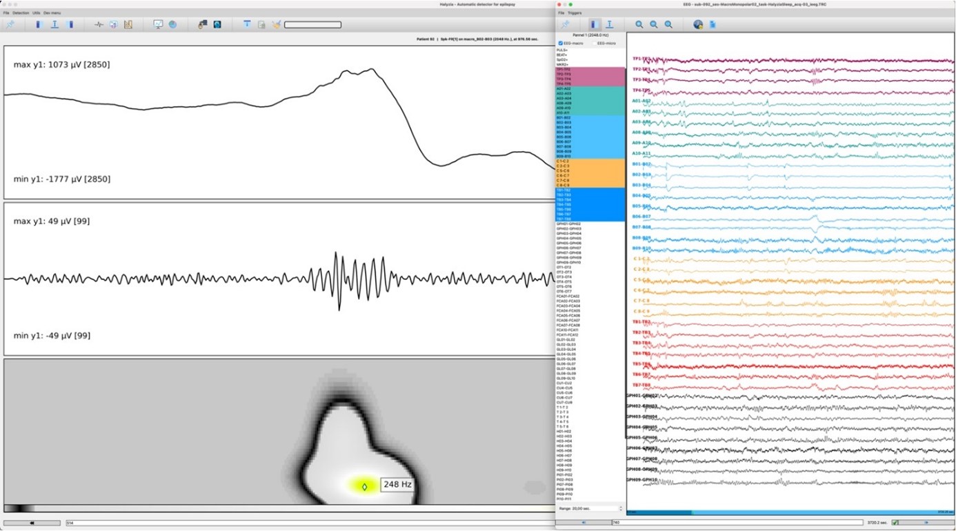 Exemple de l’interface graphique d’Halyzia avec un biomarqueur détecté en jaune