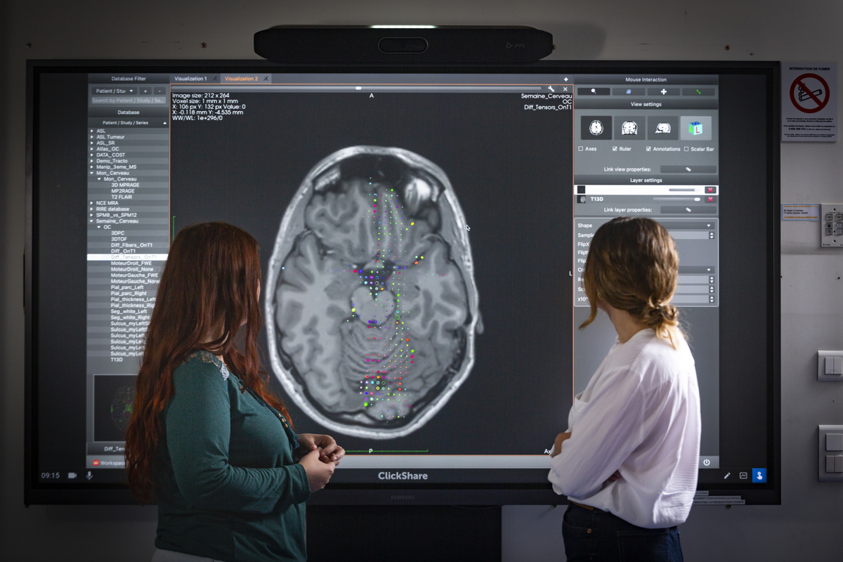 Maladies neurologiques : les microbulles d’Harmonix franchissent la barrière du cerveau